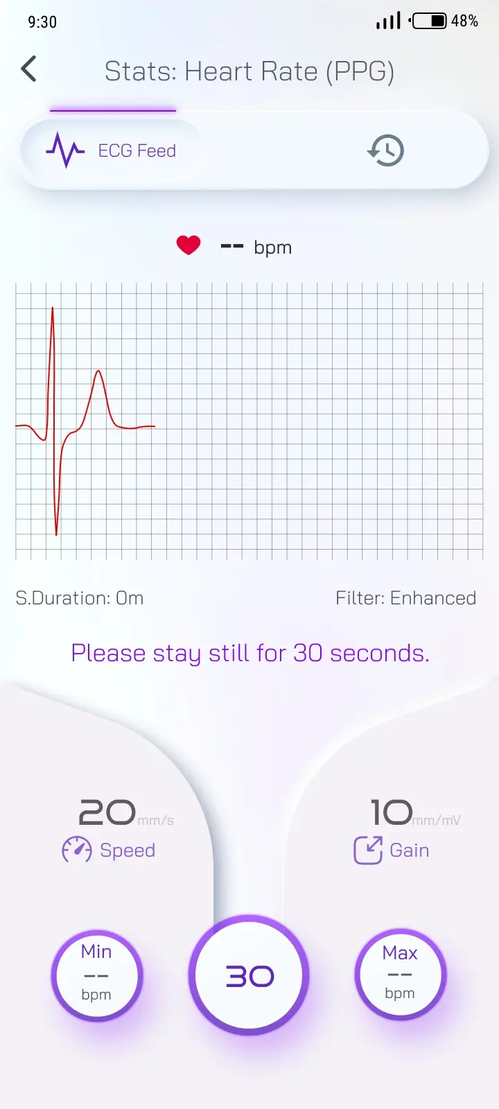 Real-time ECG waveform displayed in the Vlepis app with adjustable speed and gain controls